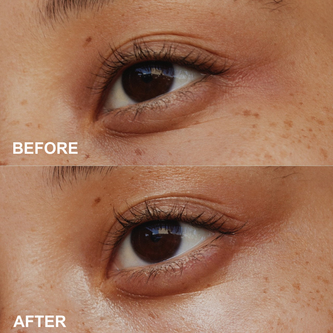 PHOFAY Anti-Aging Eye Cream – Wrinkles, Dark Circles & Puffiness