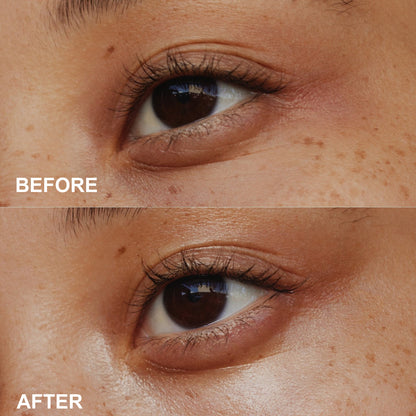 PHOFAY Anti-Aging Eye Cream – Wrinkles, Dark Circles & Puffiness