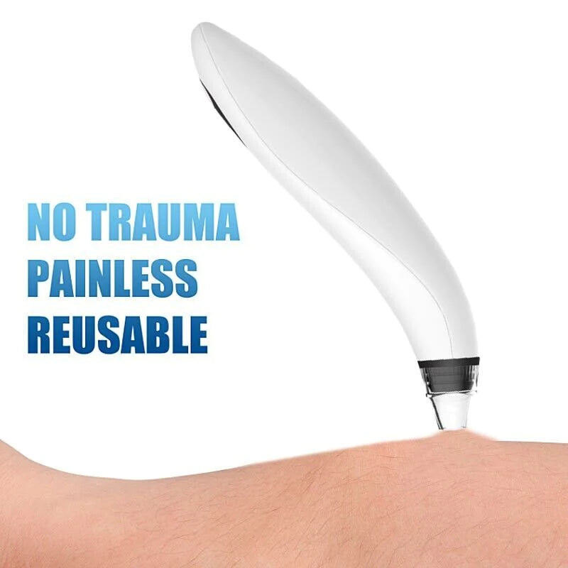 Deep Cleansing Facial Pore Blackhead & Whitehead Remover with Silicone Head - Facial Cleansing Devices Readi Gear