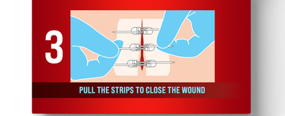 Zipper Wound Closure Kit - Stitch-Free Butterfly Bandages 4-Pack - Zipper wound closure kit Readi Gear