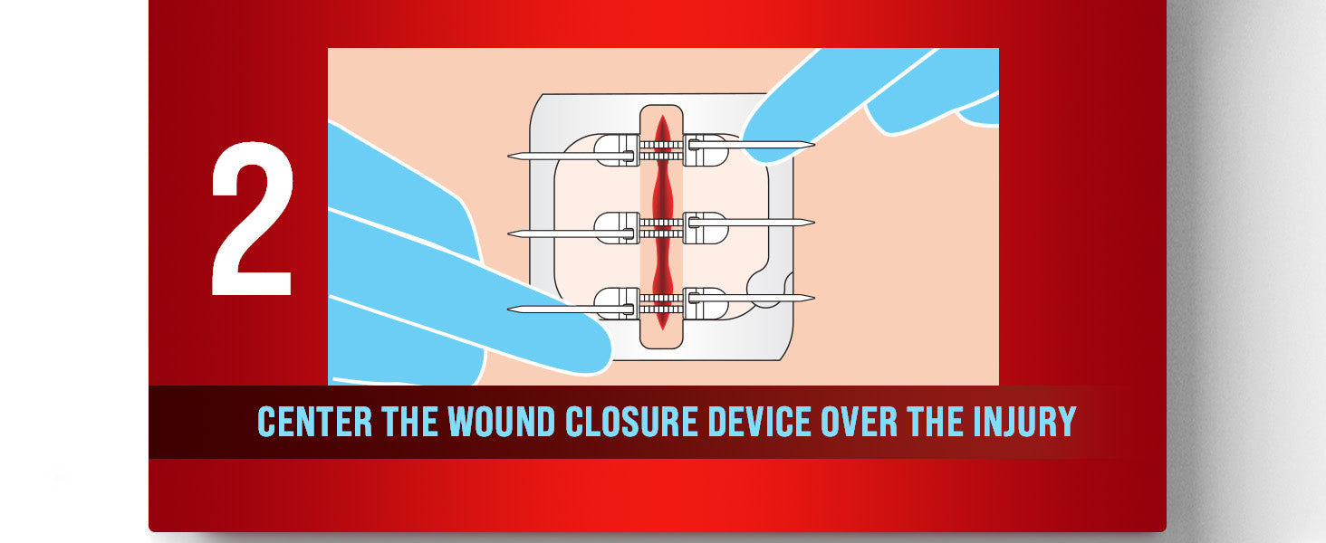 Zipper Wound Closure Kit - Stitch-Free Butterfly Bandages 4-Pack - Zipper wound closure kit Readi Gear