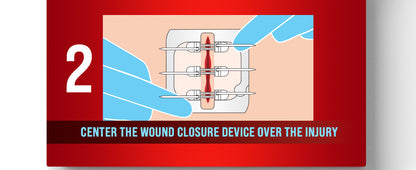 Zipper Wound Closure Kit - Stitch-Free Butterfly Bandages 4-Pack - Zipper wound closure kit Readi Gear