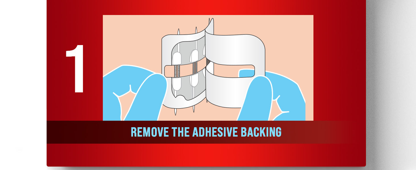 Zipper Wound Closure Kit - Stitch-Free Butterfly Bandages 4-Pack - Zipper wound closure kit Readi Gear