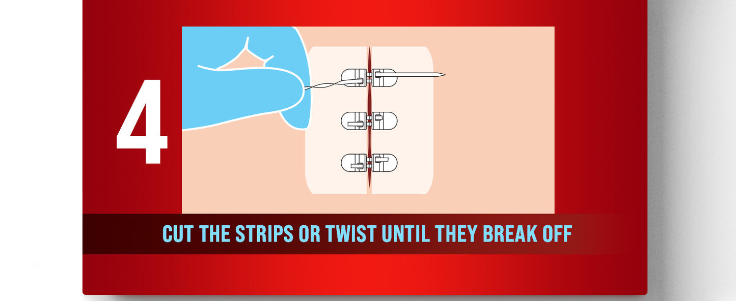 Zipper Wound Closure Kit - Stitch-Free Butterfly Bandages 4-Pack - Zipper wound closure kit Readi Gear