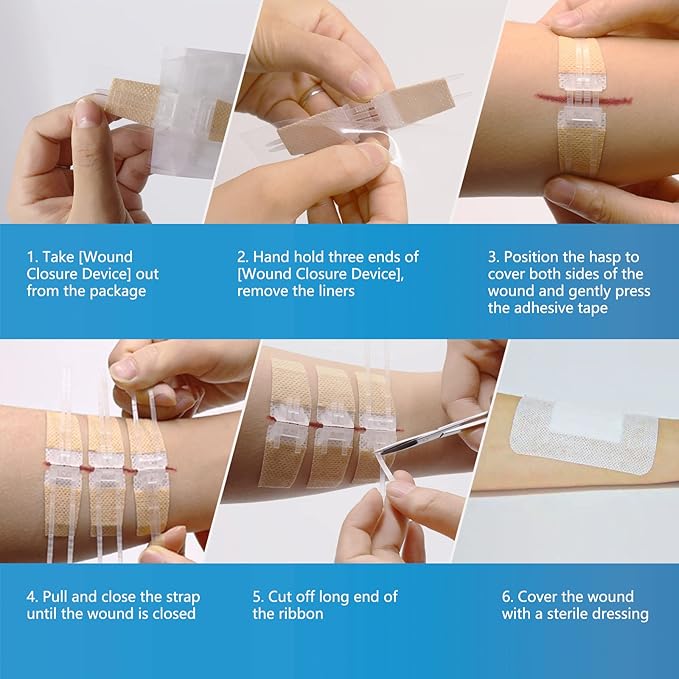 QuickZip Wound Closure Kit - No-Stitch First Aid Kit Essential - Zipper wound closure kit Readi Gear