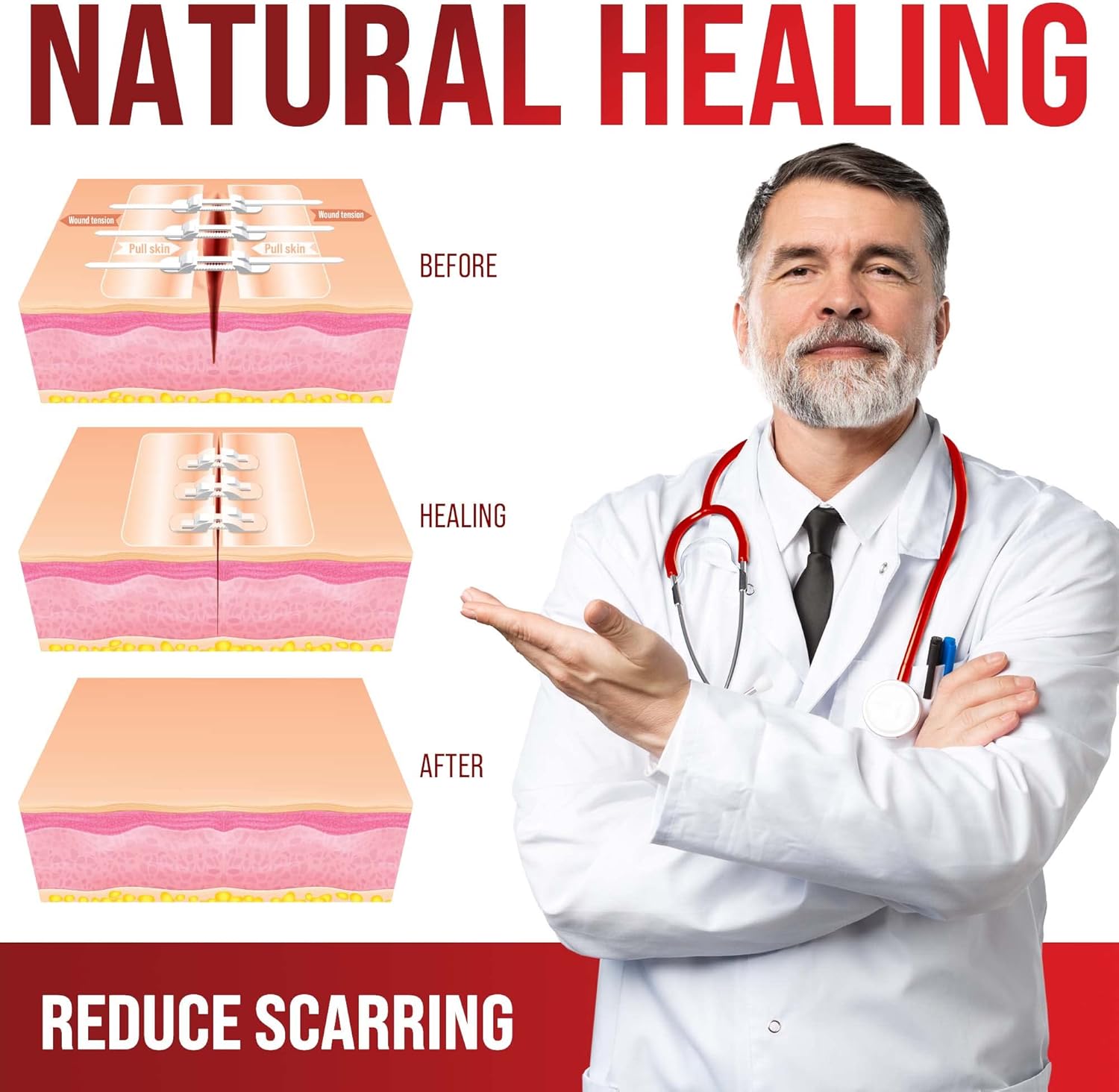 Zipper Wound Closure Kit - Stitch-Free Butterfly Bandages 4-Pack - Zipper wound closure kit Readi Gear