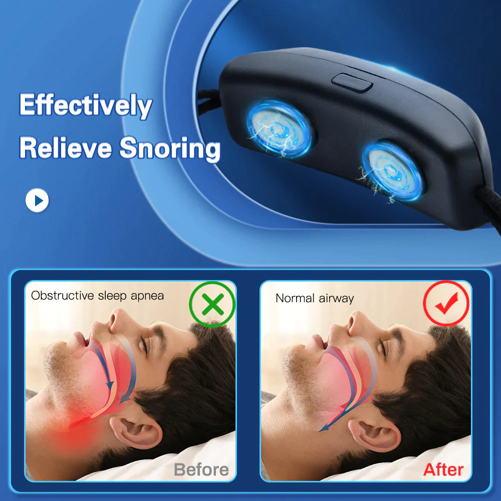 SnoreFree Pro - EMS Pulse Technology Anti Snoring Sleep Aid - anti-snoring device Readi Gear