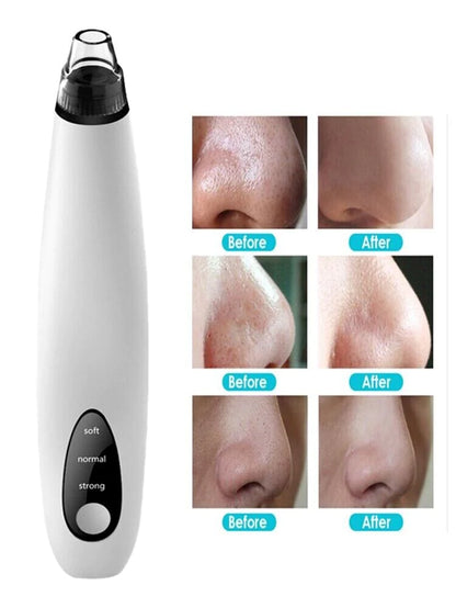 Deep Cleansing Facial Pore Blackhead & Whitehead Remover with Silicone Head - Facial Cleansing Devices Readi Gear